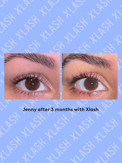 XLash Eye Lash Serum Pro 6ml LYBC