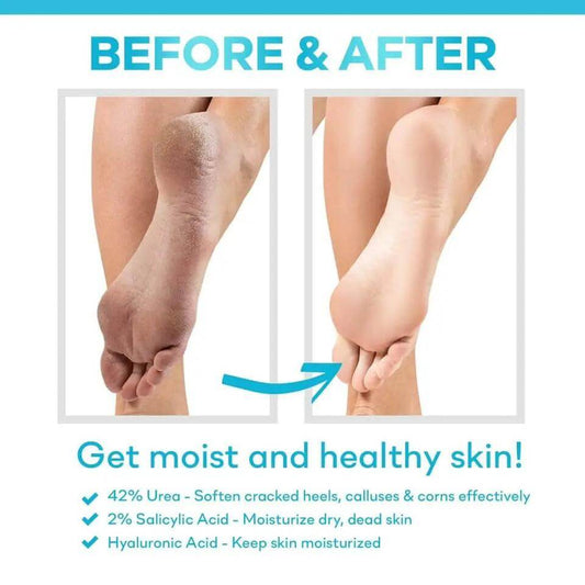 Before and after images showing CeraVe SA Renewing Foot Cream healthy, moisturized feet; highlighting 42% urea and 2% salicylic acid benefits.