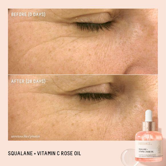 Before and after results of Biossance Squalane + Vitamin C Rose Oil showing improved skin texture in 28 days.