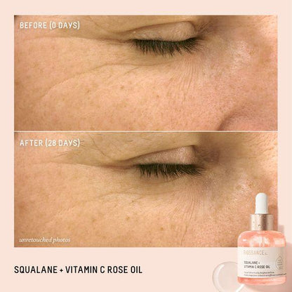 Before and after results of Biossance Squalane + Vitamin C Rose Oil showing improved skin texture in 28 days.