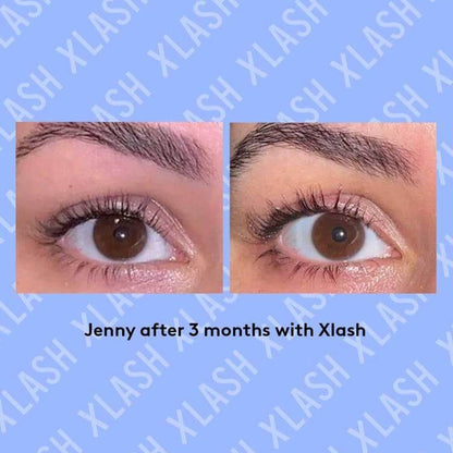 Before and after comparison of eyelash improvement after 3 months of using XLash serum.