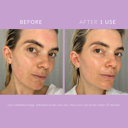 Before and after comparison of skin using Kate Somerville DeliKate Recovery Cream, showing improved texture and radiance.