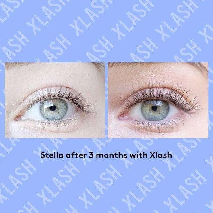 Before and after results of XLash Eye Lash Serum Pro on Stella's lashes after 3 months of use.